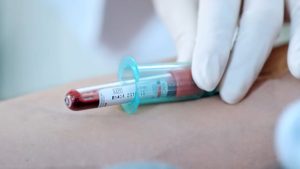 Hemoglobinuria paroxistică nocturnă, o boală rară, gravă şi frecvent subdiagnosticată
