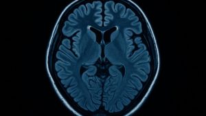 Cercetătorii japonezi au identificat cauza biologică a „ceții cerebrale” post-Covid